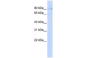 WB Suggested Anti-ZCCHC14 Antibody Titration: 0. (ZCCHC14 Antikörper  (N-Term))