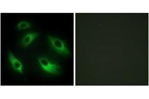 Immunofluorescence analysis of HeLa cells, using EPHB6 Antibody. (EPH Receptor B6 Antikörper  (AA 861-910))