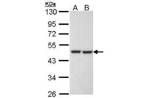 WB Image Sample (30 ug of whole cell lysate) A: H1299 B: Hela 10% SDS PAGE antibody diluted at 1:1000 (KRR1 Antikörper)