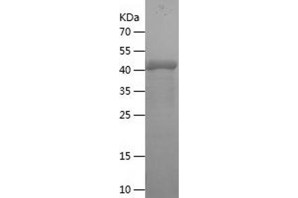 SSX1 Protein (AA 1-188) (His-IF2DI Tag)