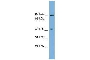 DYRK1A antibody used at 1 ug/ml to detect target protein. (DYRK1A Antikörper)