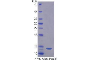 SDS-PAGE analysis of Pig Diamine Oxidase Protein. (DAO Protein)