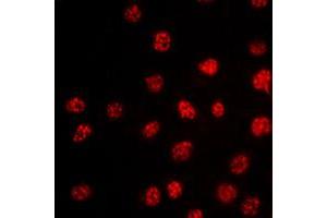 Immunofluorescent analysis of TBX15/18 staining in HepG2 cells. (T-Box 15/18 Antikörper  (Center))