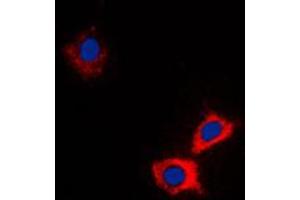 Immunofluorescent analysis of ABCB10 staining in HeLa cells.