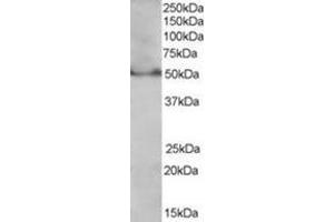 Image no. 1 for anti-Peroxisome Proliferator-Activated Receptor delta (PPARD) (C-Term), (Isoform 1) antibody (ABIN374465) (PPARD Antikörper  (C-Term, Isoform 1))
