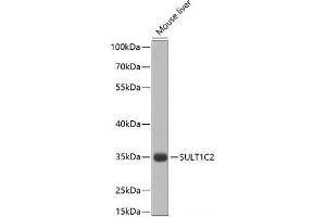 Western blot analysis of extracts of Mouse liver using SULT1C2 Polyclonal Antibody at dilution of 1:1000. (SULT1C2 Antikörper)