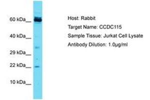 Image no. 1 for anti-Coiled-Coil Domain Containing 115 (CCDC115) (AA 47-96) antibody (ABIN6750443) (CCDC115 Antikörper  (AA 47-96))