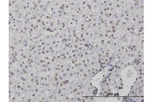 Immunoperoxidase of monoclonal antibody to CSTB on formalin-fixed paraffin-embedded human liver. (CSTB Antikörper  (AA 1-98))