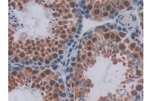 Immunohistochemistry (IHC) image for anti-Endoglin (ENG) (AA 27-137) antibody (ABIN7432973)