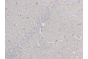 Immunohistochemistry (IHC) image for anti-Tubulin, beta 3 (TUBB3) antibody (ABIN1112834)