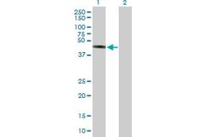 Western Blot analysis of TRIM44 expression in transfected 293T cell line by TRIM44 MaxPab polyclonal antibody. (TRIM44 Antikörper  (AA 1-344))