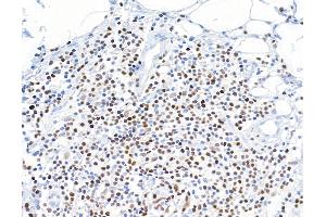 Immunohistochemistry (IHC) image for anti-Runt-Related Transcription Factor 3 (RUNX3) (AA 1-50) antibody (ABIN7454015)