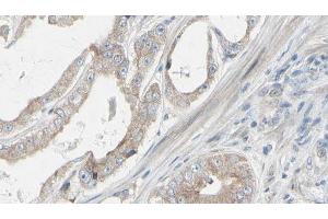 ABIN6272312 at 1/100 staining Human prostate tissue by IHC-P.