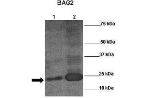 Sample Type: Lane 1:241 µg untransfected H1299 cells Lane 2: 041 µg siRUVBL2 transfected H1299 cells Primary Antibody Dilution: 1:0000Secondary Antibody: Anti-rabbit-HRP Secondary Antibody Dilution: 1:0000 Color/Signal Descriptions: RUVBL2  Gene Name: Wenwei Hu, Xuetian Yue, Rutgers Cancer Institute of New Jersey. (RUVBL2 Antikörper  (N-Term))