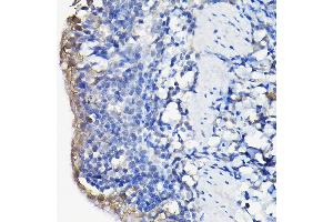 Immunohistochemistry of paraffin-embedded rat lung using Galectin 3/Galectin 3/LG Rabbit pAb (ABIN7267338) at dilution of 1:100 (40x lens). (Galectin 3 Antikörper  (AA 1-250))