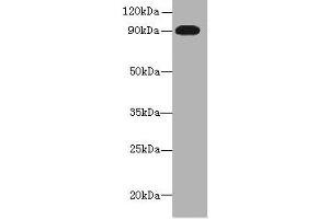 Western blot All lanes: NRG2 antibody at 16 μg/mL + U251 whole cell lysate Secondary Goat polyclonal to rabbit IgG at 1/10000 dilution Predicted band size: 92, 91, 93, 47, 46, 68, 71 kDa Observed band size: 92 kDa (Neuregulin 2 Antikörper  (AA 112-405))