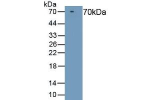 Detection of Recombinant F10, Rat using Polyclonal Antibody to Coagulation Factor X (F10) (Coagulation Factor X Antikörper  (AA 21-482))
