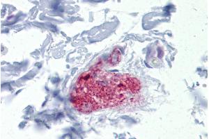 Immunohistochemistry with Colon, submucosal plexus tissue at an antibody concentration of 5µg/ml using anti-NOTCH4 antibody (ARP32052_P050) (NOTCH4 Antikörper  (Middle Region))