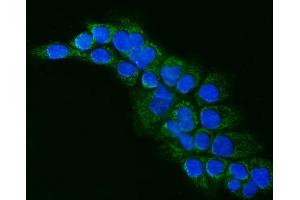anti-Aldehyde Dehydrogenase 1 Family, Member B1 (ALDH1B1) (AA 116-156), (N-Term) antibody