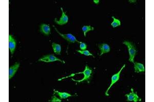 Immunofluorescent analysis of U251 cells using ABIN7161179 at dilution of 1:100 and Alexa Fluor 488-congugated AffiniPure Goat Anti-Rabbit IgG(H+L) (Nestin Antikörper  (AA 1321-1569))