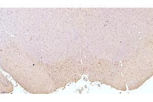 Immunohistochemistry (IHC) image for anti-Tyrosine Hydroxylase (TH) (AA 82-310) antibody (ABIN7433633)