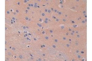 Detection of HEXb in Mouse Cerebrum Tissue using Polyclonal Antibody to Hexosaminidase B Beta (HEXb)