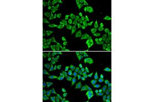 Immunofluorescence analysis of HeLa cell using DDX20 antibody. (DDX20 Antikörper)
