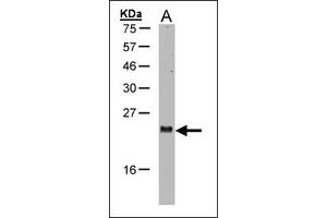 Western blot: Sample (30 µg of whole cell lysate). (ARL2 Antikörper  (AA 123-184))
