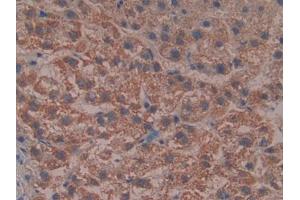 DAB staining on IHC-P; Samples: Human Liver Tissue (Reelin Antikörper  (AA 3142-3460))