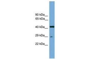 Image no. 1 for anti-Regulatory Factor X-Associated Protein (RFXAP) (AA 101-150) antibody (ABIN6744620) (RFXAP Antikörper  (AA 101-150))