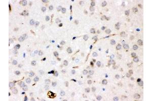 IHC testing of FFPE rat brain with CP antibody. (Ceruloplasmin Antikörper  (AA 20-258))