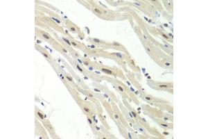 Immunohistochemistry of paraffin-embedded mouse heart using UPF1/RENT1 antibody  at dilution of 1:100 (40x lens). (RENT1/UPF1 Antikörper  (AA 270-370))