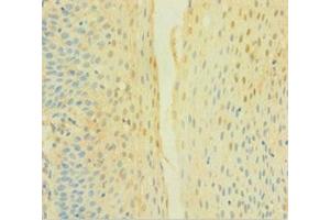 Immunohistochemistry of paraffin-embedded human tonsil tissue using ABIN7149094 at dilution of 1:100 (CYBB Antikörper  (AA 283-570))