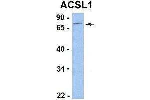 Hum. (ACSL1 Antikörper  (C-Term))