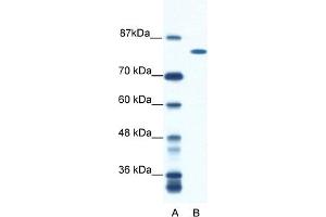 WB Suggested Anti-DHX16 Antibody Titration:  0. (DHX16 Antikörper  (N-Term))