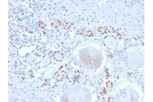 Formalin-fixed, paraffin-embedded human Kidney stained with PAX8 Recombinant Rabbit Monoclonal Antibody (PAX8/2774R). (Rekombinanter PAX8 Antikörper  (AA 60-261))