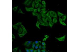Immunofluorescence analysis of A549 cells using SMYD5 Polyclonal Antibody (SMYD5 Antikörper)