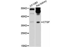 Western blot analysis of extracts of various cell lines, using CTGF antibody (ABIN5997528) at 1/1000 dilution. (CTGF Antikörper)