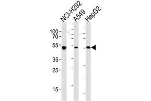 Western blot analysis of lysate from NCI-H292, A549, HepG2 cell line (left to right) using ALDH2 antibody at 1:1000 for each lane.