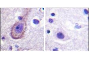 Immunohistochemistry analysis of paraffin-embedded human brain, using Kv7. (KCNQ3 Antikörper  (pThr217))