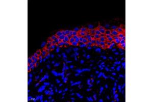 Immunofluorescent analysis of paraffin embedded rat bladder using PMCA1 (ABIN7073155) at dilution of 1: 500 (ATP2B1 Antikörper)