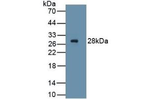 WB of Protein Standard: different control antibodies against Highly purified E. (PDGFRA ELISA Kit)