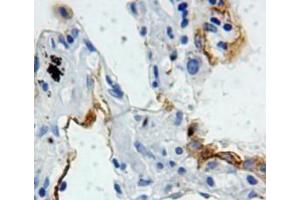 Used in DAB staining on fromalin fixed paraffin-embedded lung tissue (SFTPB Antikörper  (AA 201-381))