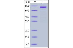 SDS-PAGE (SDS) image for Interleukin 12 Receptor beta 1 (IL12RB1) (AA 24-540) (Active) protein (Fc Tag) (ABIN6809859)