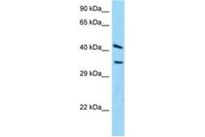 Image no. 1 for anti-ADP-Ribosylarginine Hydrolase (ADPRH) (C-Term) antibody (ABIN6748205) (ADPRH Antikörper  (C-Term))