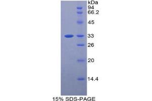 SDS-PAGE analysis of Mouse BST1 Protein. (BST1 Protein)