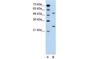 CACNB1 antibody used at 0. (CACNB1 Antikörper  (Middle Region))