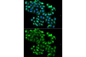 Immunofluorescence analysis of A549 cells using PHF11 antibody (ABIN5975729).