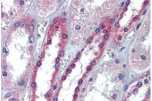 Human Kidney: Formalin-Fixed, Paraffin-Embedded (FFPE) (Occludin Antikörper  (AA 35-84))