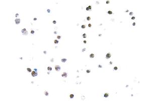 Immunocytochemistry (ICC) image for anti-Thymus High Mobility Group Box Protein (TOX) (AA 50-100) antibody (ABIN7453374) (Rekombinanter TOX Antikörper  (AA 50-100))
